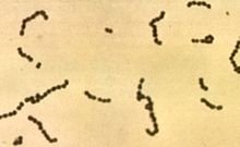 220px-Streptococci